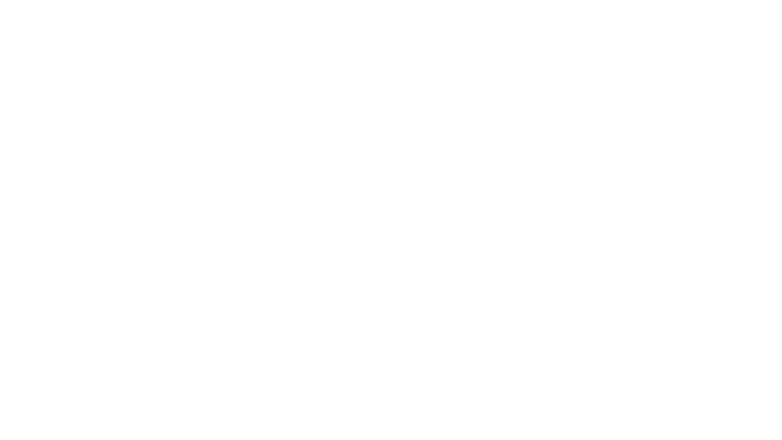 Tinnitus is the perception of noises within the ears or head (e.g., ringing, buzzing, whooshing, roaring, crickets, etc.) in the absence of an external sound.