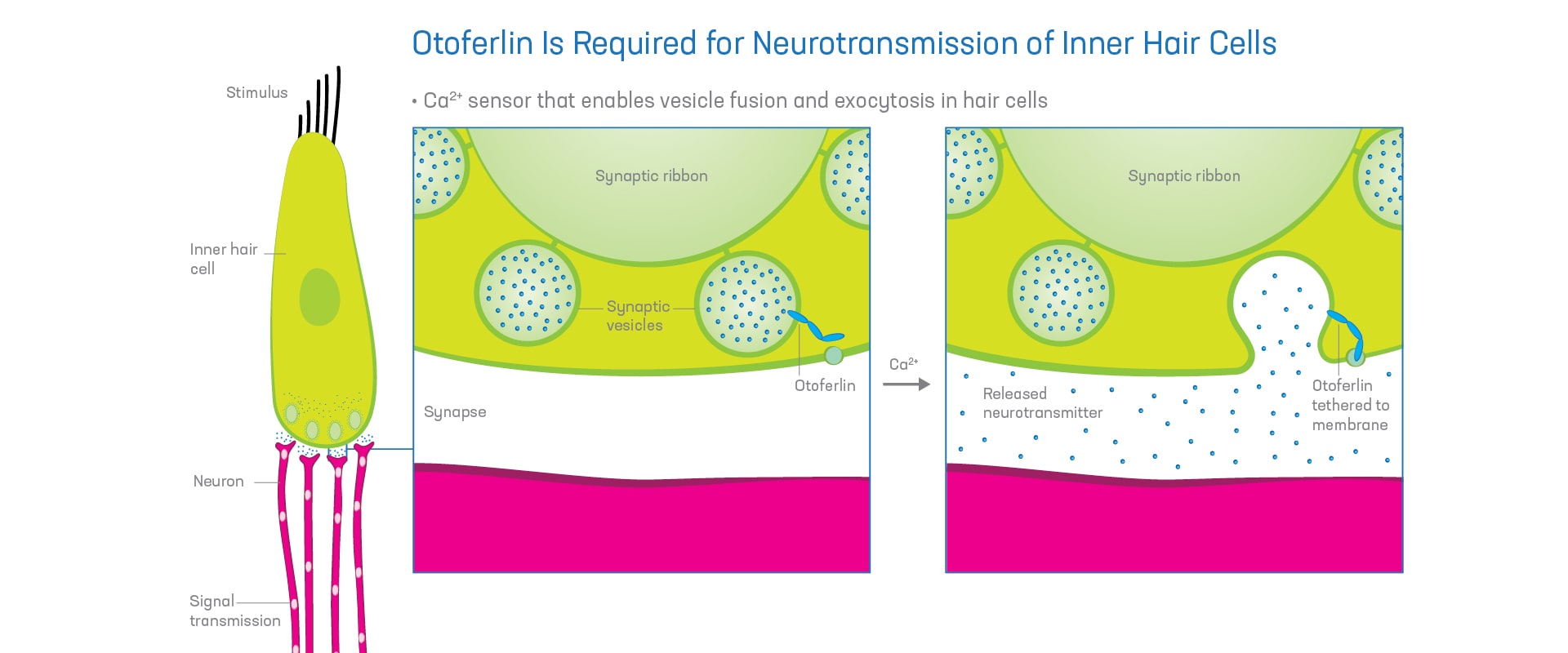 ON TREND | A Free Genetic Test Opens Doors for Children with Auditory Neuropathy