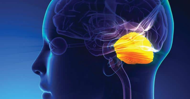 Illustration of a tumor in the head close to the inner ear