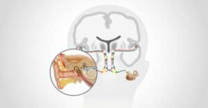 Illustration of tinnitus management