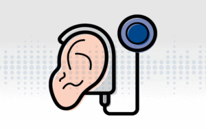 Illustration of an isolated cochlear implant