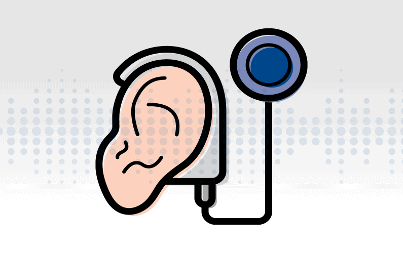 Illustration of an isolated cochlear implant