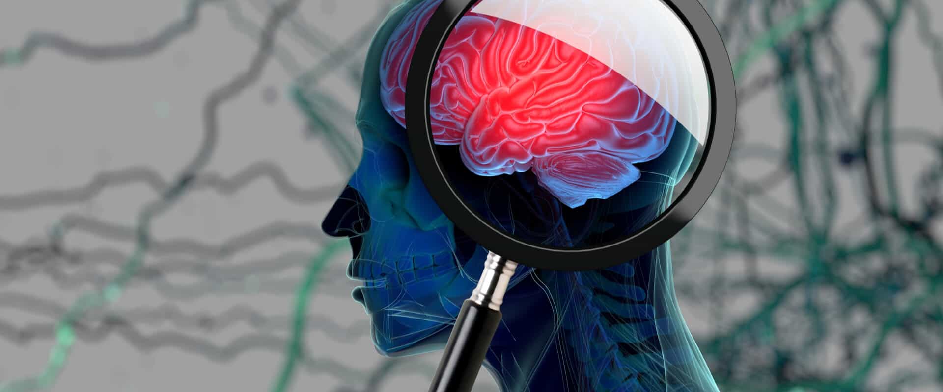 Hearing Loss Added as Modifiable Risk Factor for Dementia in National Plan to Address Alzheimer’s Disease(Anatomy Image/shutterstock.com)