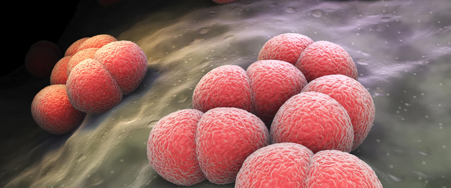 Risk of Sequelae After Invasive Meningococcal Disease (Tatiana Shepeleva/shutterstock.com)